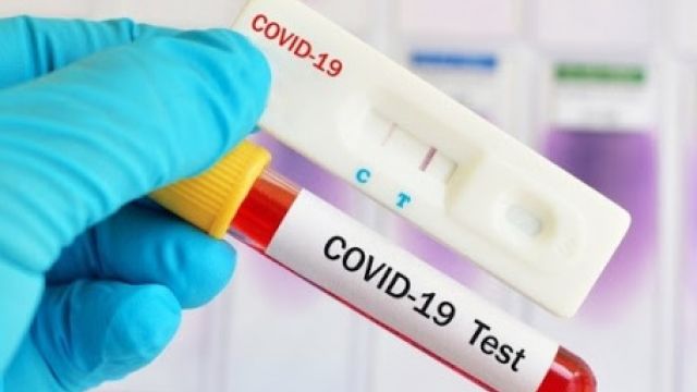 COVID-19 PCR ve ANTİKOR TESTİ
